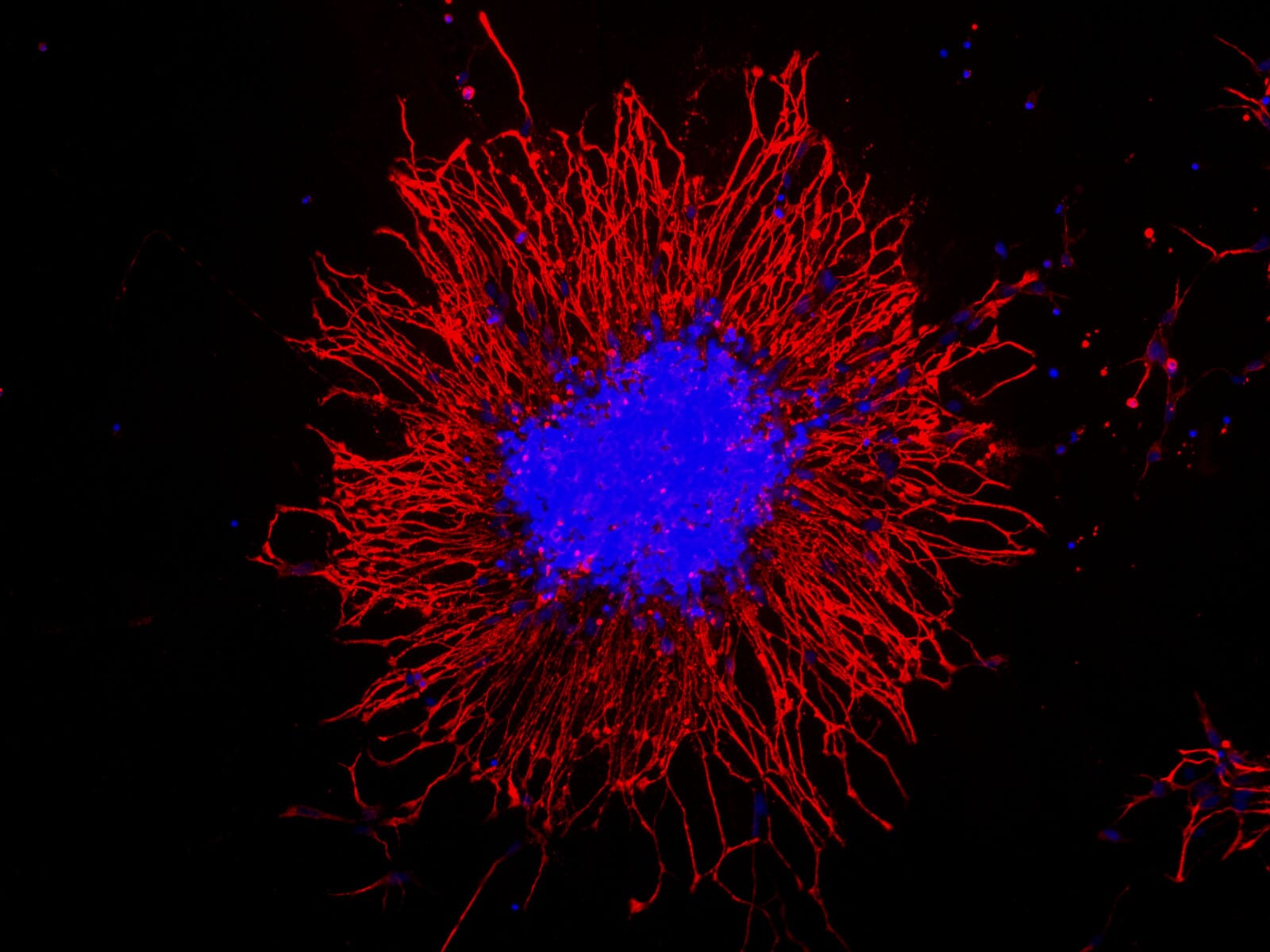 Anti-Vimentin Antibody (A85421) | Antibodies.com