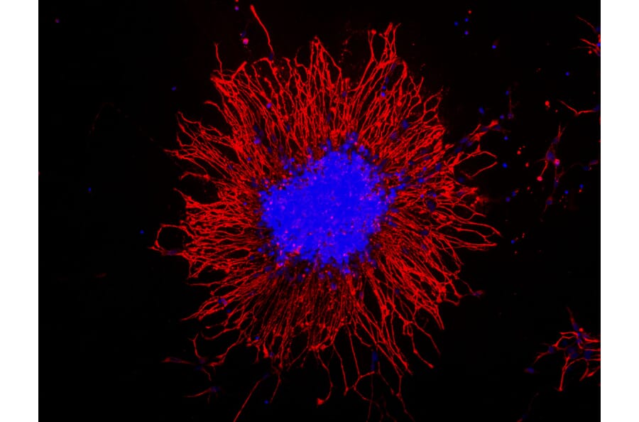 Immunofluorescence - Anti-Vimentin Antibody (A85421) - Antibodies.com