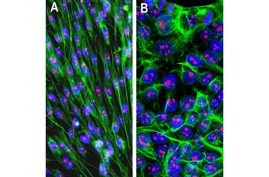 Immunofluorescence - Anti-Vimentin Antibody (A85421) - Antibodies.com