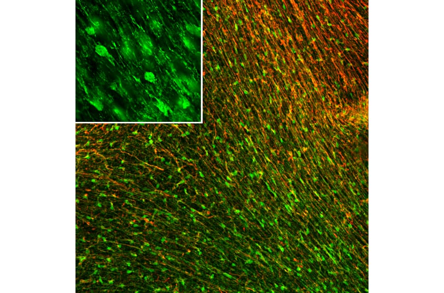Immunofluorescence - Anti-Vimentin Antibody (A85421) - Antibodies.com