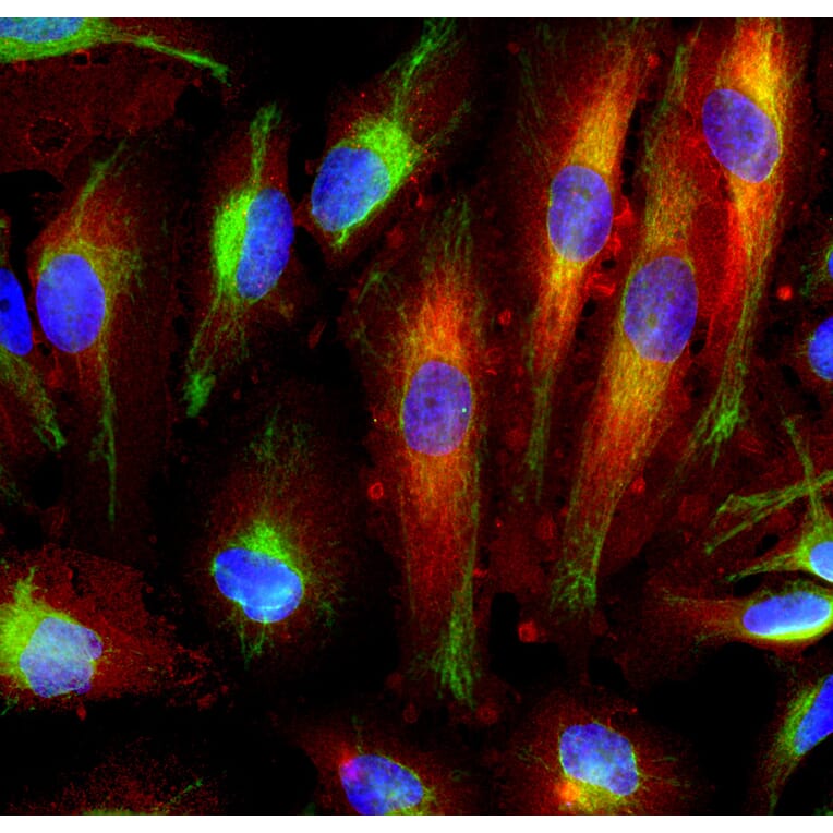 Immunofluorescence - Anti-Vimentin Antibody (A85421) - Antibodies.com