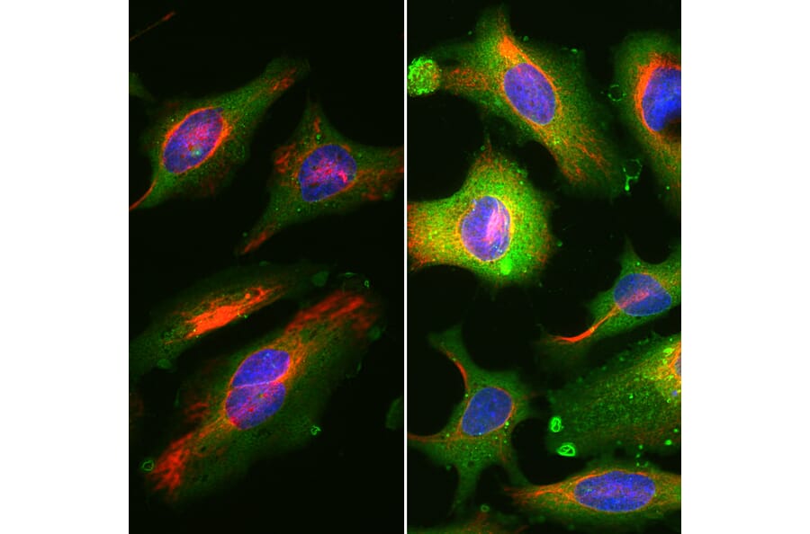 Immunofluorescence - Anti-Vimentin Antibody (A85421) - Antibodies.com