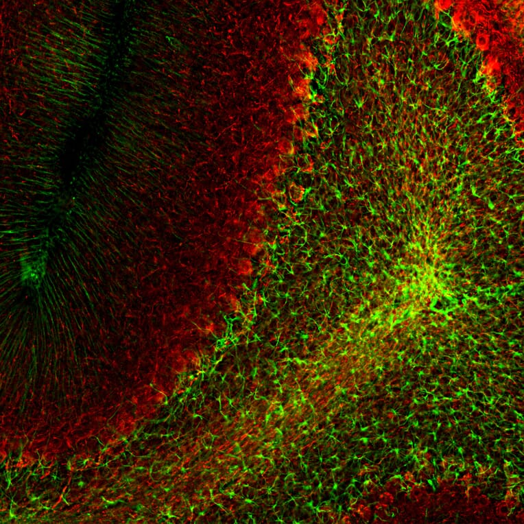 Immunofluorescence - Anti-GFAP Antibody [5C10] (A85422) - Antibodies.com