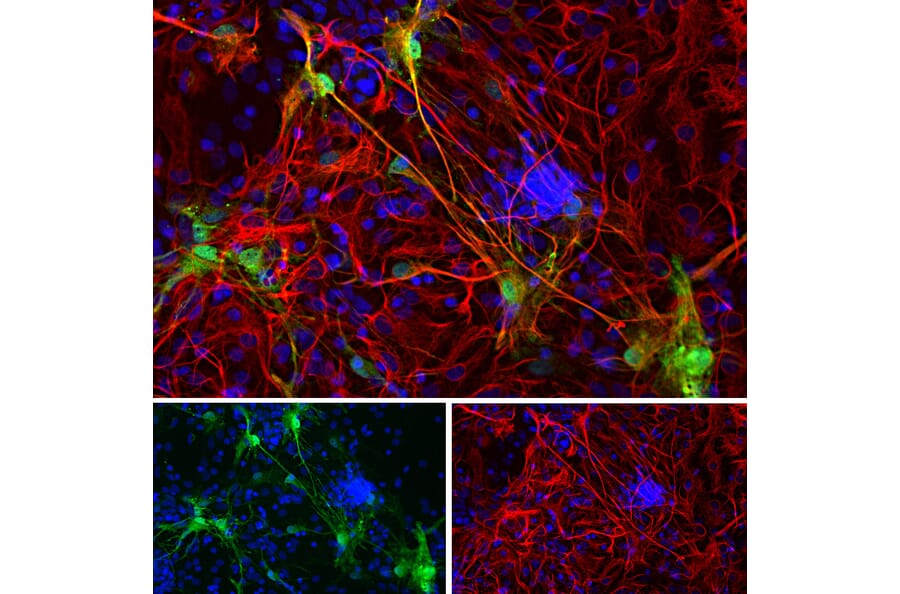 Immunofluorescence - Anti-GFAP Antibody [5C10] (A85422) - Antibodies.com