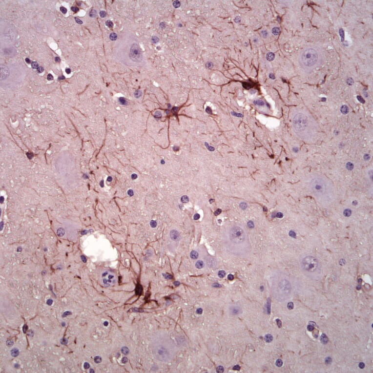 Immunohistochemistry - Anti-GFAP Antibody [5C10] (A85422) - Antibodies.com