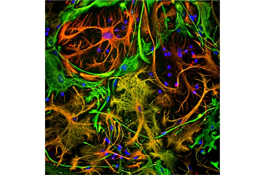 Immunofluorescence - Anti-Vimentin Antibody [2A52] (A85423) - Antibodies.com