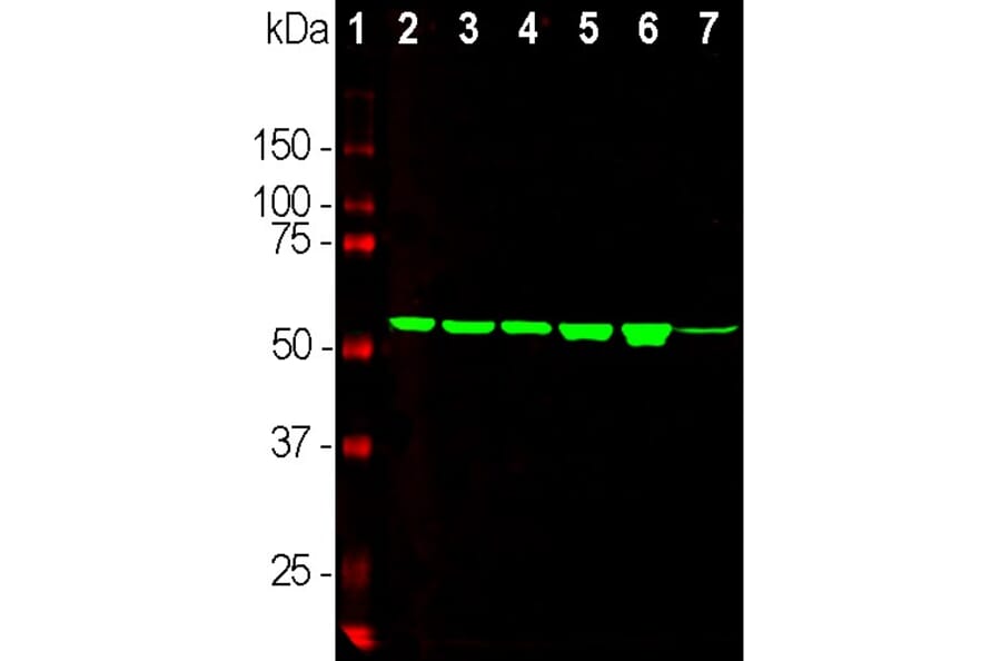 Western Blot - Anti-Vimentin Antibody [2A52] (A85423) - Antibodies.com
