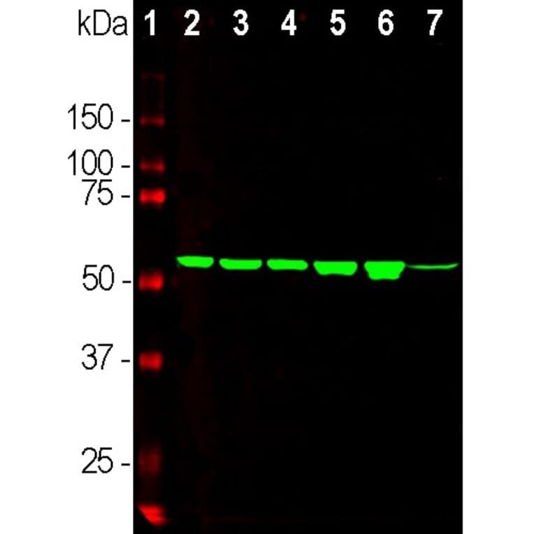 Western Blot - Anti-Vimentin Antibody [2A52] (A85423) - Antibodies.com