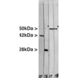 Western Blot - Anti-Vimentin Antibody [2A52] (A85423) - Antibodies.com