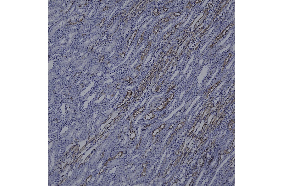 Immunohistochemistry - Anti-Vimentin Antibody [2A52] (A85423) - Antibodies.com