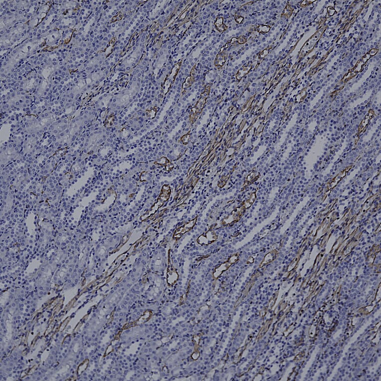 Immunohistochemistry - Anti-Vimentin Antibody [2A52] (A85423) - Antibodies.com