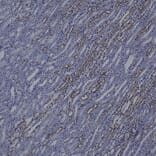 Immunohistochemistry - Anti-Vimentin Antibody [2A52] (A85423) - Antibodies.com