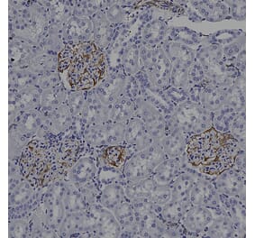 Immunohistochemistry - Anti-Vimentin Antibody [2D1] (A85424) - Antibodies.com
