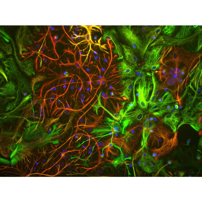 Immunofluorescence - Anti-Vimentin Antibody [2D1] (A85424) - Antibodies.com