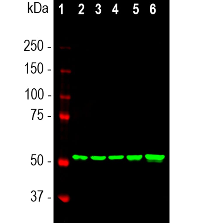 Western Blot - Anti-Vimentin Antibody [2D1] (A85424) - Antibodies.com