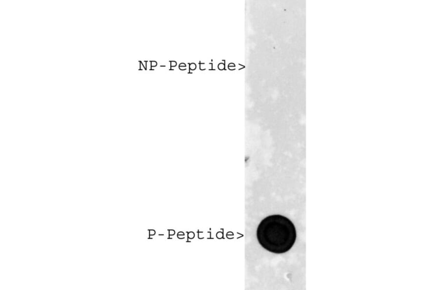 Dot Blot - Anti-phospho MeCP2 (S421) Antibody - Antibodies.com (A85426)