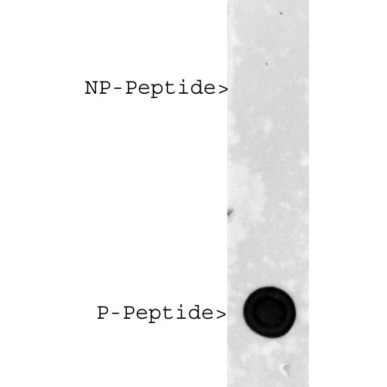 Dot Blot - Anti-phospho MeCP2 (S421) Antibody - Antibodies.com (A85426)