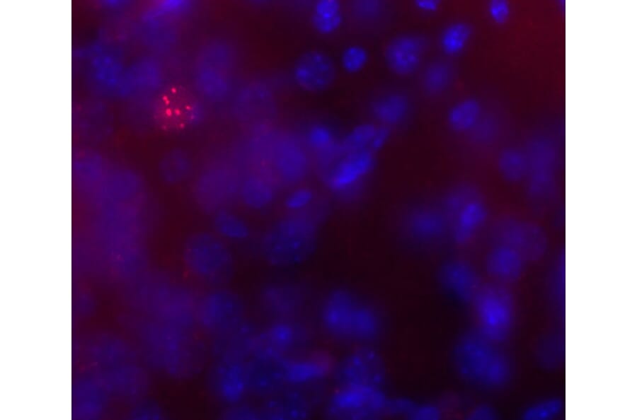 Immunofluorescence - Anti-Phospho-MeCP2 (S421) Antibody (A85426) - Antibodies.com