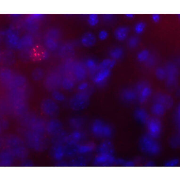 Immunofluorescence - Anti-Phospho-MeCP2 (S421) Antibody (A85426) - Antibodies.com