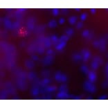 Immunofluorescence - Anti-Phospho-MeCP2 (S421) Antibody (A85426) - Antibodies.com