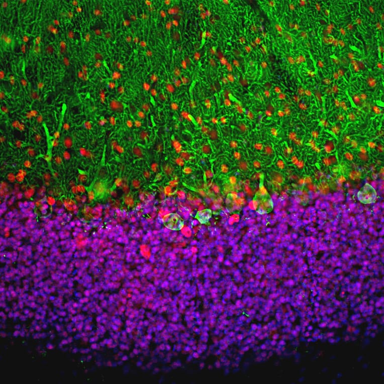 Immunofluorescence - Anti-MeCP2 Antibody (A85427) - Antibodies.com