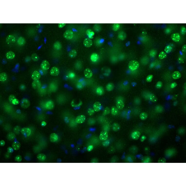 Immunofluorescence - Anti-MeCP2 Antibody (A85427) - Antibodies.com