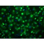 Immunofluorescence - Anti-MeCP2 Antibody (A85427) - Antibodies.com