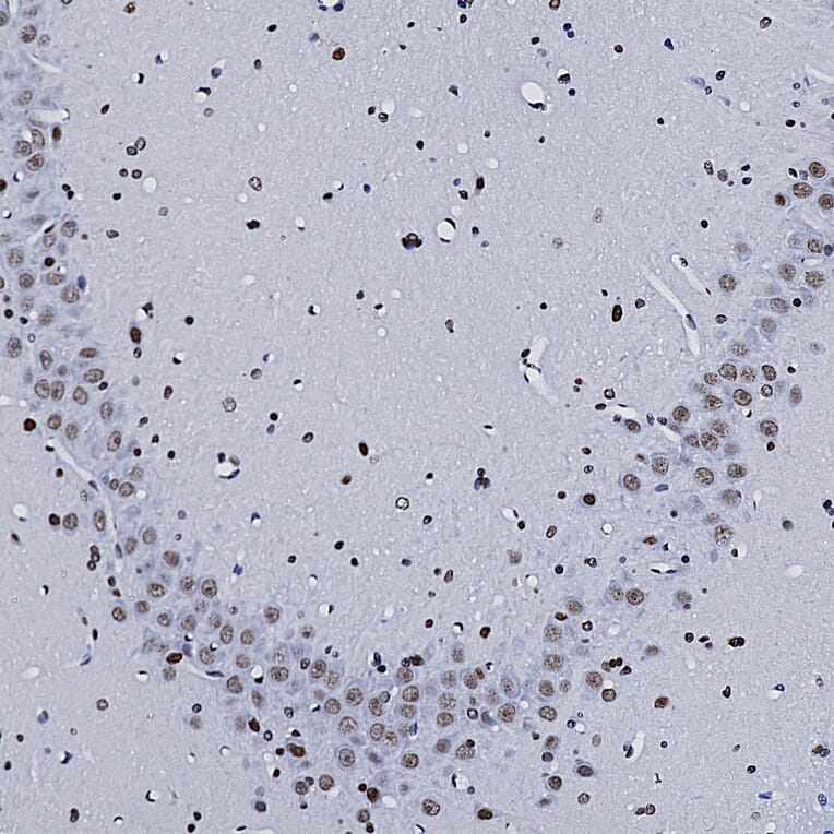 Immunohistochemistry - Anti-MeCP2 Antibody (A85427) - Antibodies.com