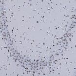 Immunohistochemistry - Anti-MeCP2 Antibody (A85427) - Antibodies.com