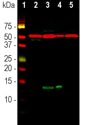 The clinical drug candidate anle138b binds in a cavity of