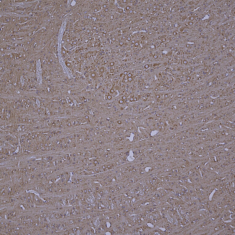 Immunohistochemistry - Anti-beta Tubulin Antibody [4E4] (A85429) - Antibodies.com