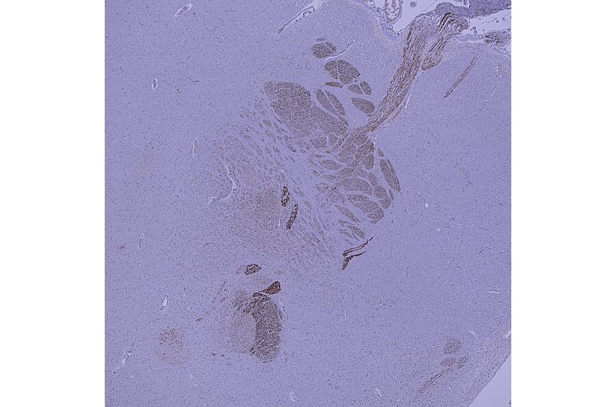 Immunohistochemistry - Anti-Peripherin Antibody (A85430) - Antibodies.com