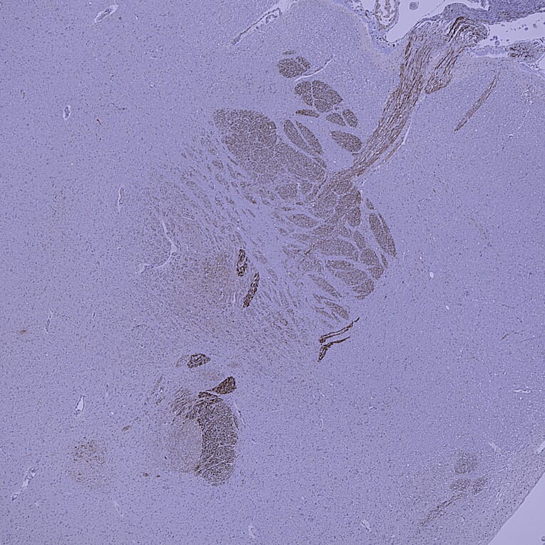 Immunohistochemistry - Anti-Peripherin Antibody (A85430) - Antibodies.com