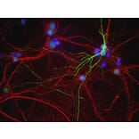 Immunofluorescence - Anti-Peripherin Antibody (A85430) - Antibodies.com