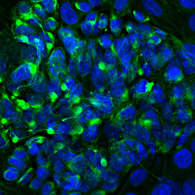 Immunofluorescence - Anti-Peripherin Antibody (A85430) - Antibodies.com