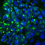 Immunofluorescence - Anti-Peripherin Antibody (A85430) - Antibodies.com