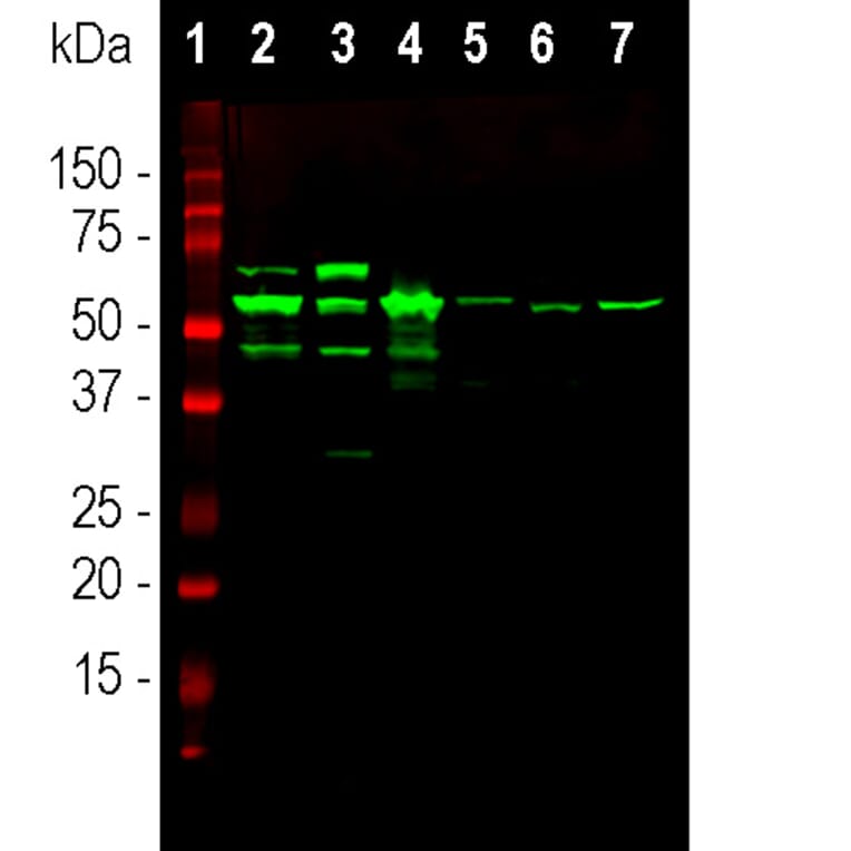 Western Blot - Anti-Peripherin Antibody (A85430) - Antibodies.com