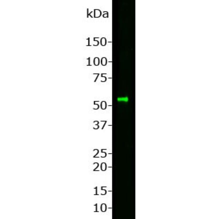 Western Blot - Anti-Peripherin Antibody (A85430) - Antibodies.com