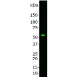 Western Blot - Anti-Peripherin Antibody (A85430) - Antibodies.com