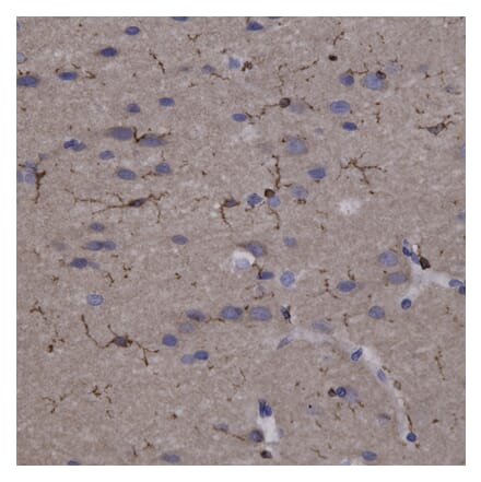 Immunohistochemistry - Anti-Coronin 1a Antibody (A85431) - Antibodies.com