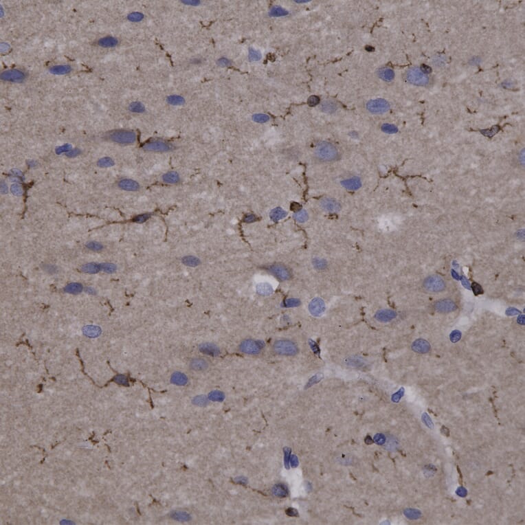 Immunohistochemistry - Anti-Coronin 1a Antibody (A85431) - Antibodies.com