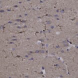 Immunohistochemistry - Anti-Coronin 1a Antibody (A85431) - Antibodies.com