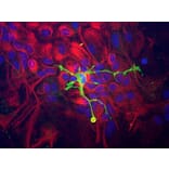 Immunocytochemistry - Anti-Coronin 1a Antibody (A85431) - Antibodies.com