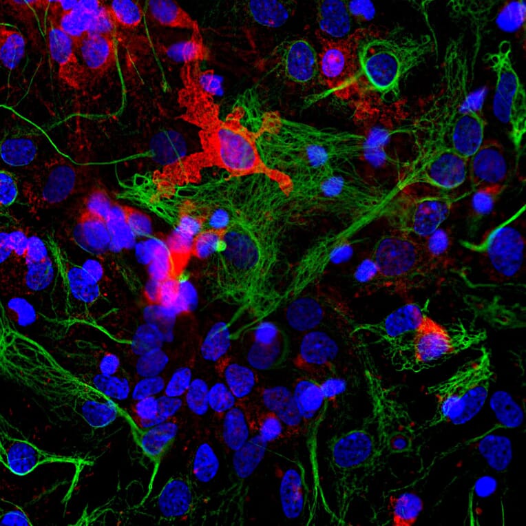 Immunofluorescence - Anti-Coronin 1a Antibody (A85431) - Antibodies.com