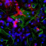 Immunofluorescence - Anti-Coronin 1a Antibody (A85431) - Antibodies.com