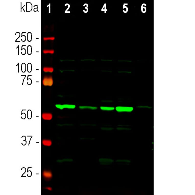 Western Blot - Anti-Coronin 1a Antibody (A85431) - Antibodies.com