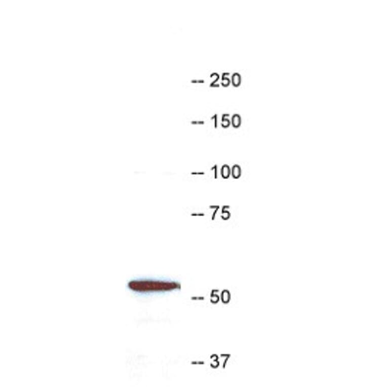 Western Blot - Anti-Coronin 1a Antibody (A85431) - Antibodies.com