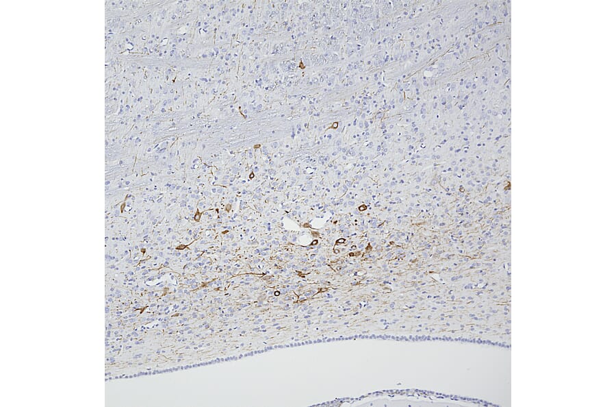 Immunohistochemistry - Anti-Peripherin Antibody [7C5] (A85432) - Antibodies.com