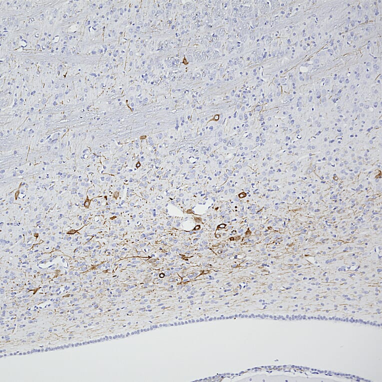 Immunohistochemistry - Anti-Peripherin Antibody [7C5] (A85432) - Antibodies.com