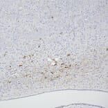 Immunohistochemistry - Anti-Peripherin Antibody [7C5] (A85432) - Antibodies.com